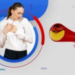 هل تختلف أعراض انسداد الشرايين عند النساء عن الرجال؟