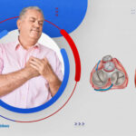 ما هي أمراض صمامات القلب وعلاجها؟