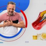 ما هي أنواع دعامات القلب؟| فوائدها واسعارها