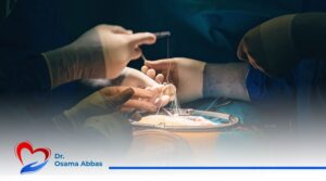 ارتخاء-الصمام-الميترالى