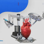 اسباب اجراء عملية القلب المفتوح