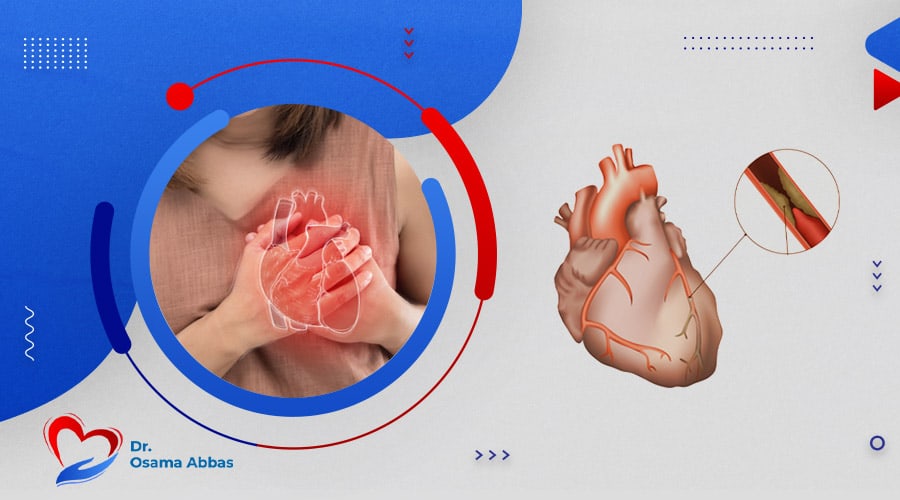 اسباب جلطة الشريان التاجي|اسباب جلطة الشريان التاجي