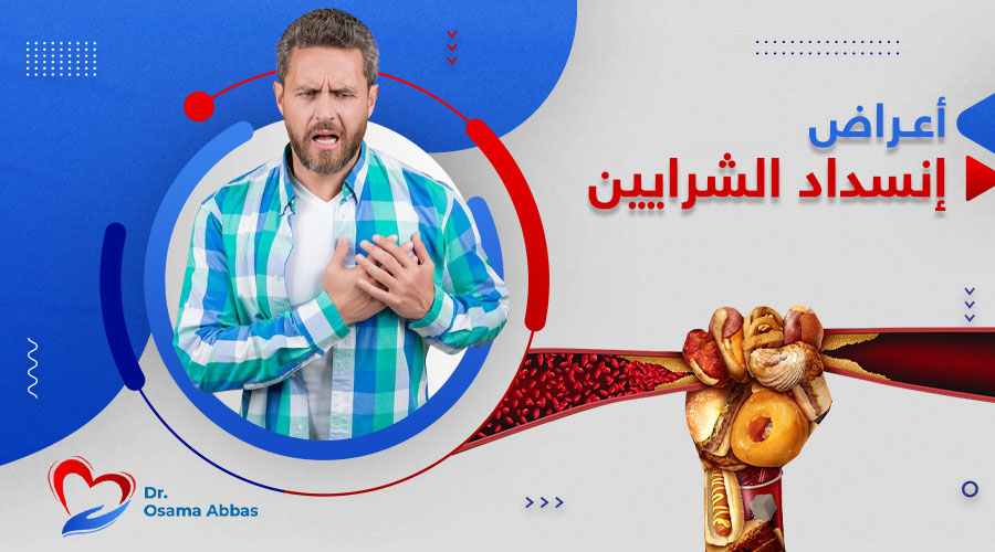 تعرف على أبرز اعراض انسداد الشرايين في القلب اعراض انسداد الشرايين