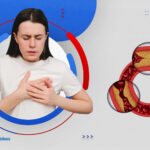 ما هي امراض الشرايين التاجية واعراضها؟