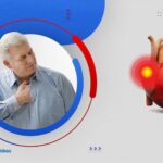 اورام القلب: الانواع ،والاسباب، وطرق العلاج