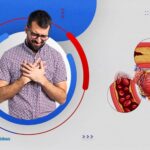 تعرف على أسباب جلطات القلب