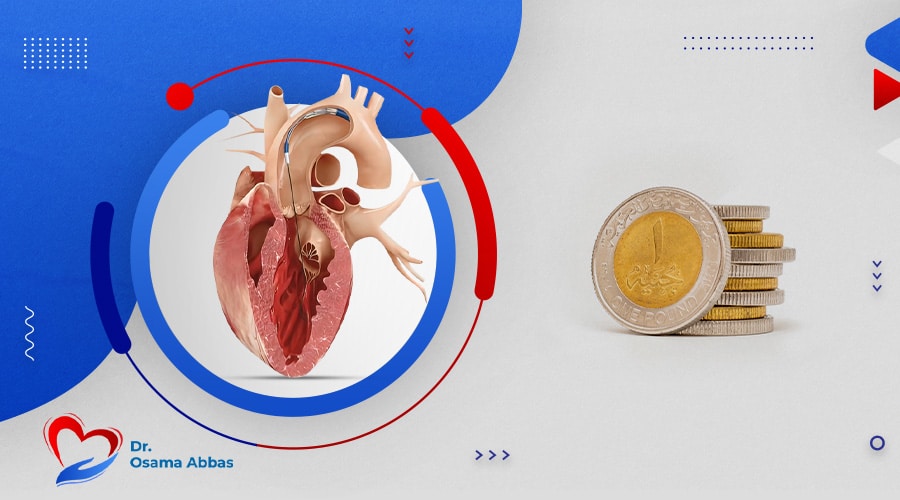 تكلفة عملية قسطرة القلب