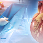 ما هي جراحة القلب بالمنظار دون شق الصدر؟