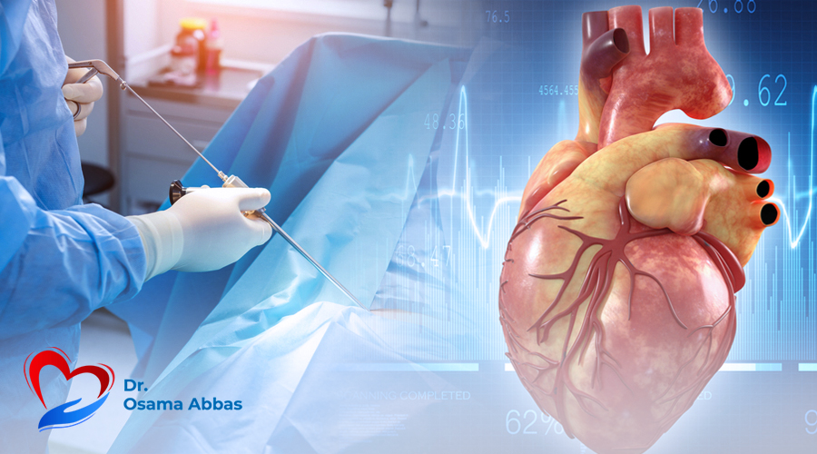 جراحة القلب بالمنظار دون شق الصدر جراحة القلب بالمنظار دون شق الصدر