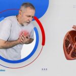 درجات ارتخاء الصمام الميترالي