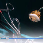 ما هو سعر عملية تغيير صمام القلب؟ | وعوامل تكلفتها