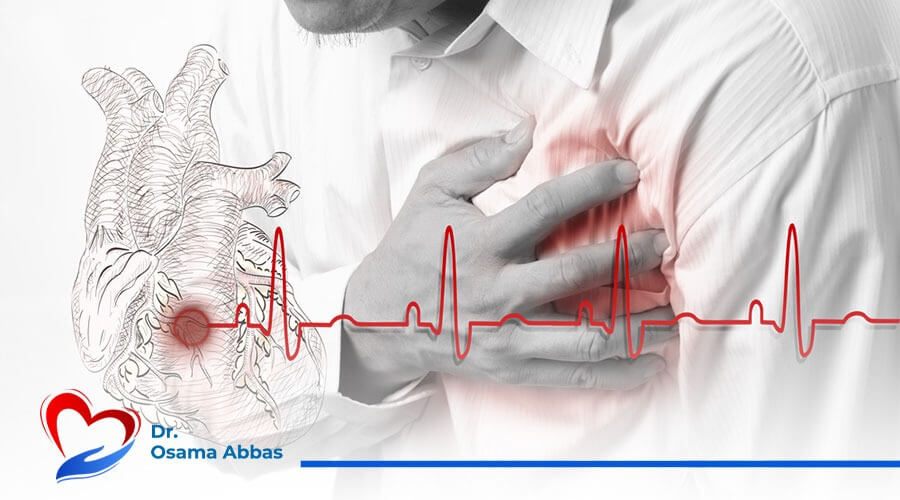 اعراض الذبحة الصدرية|علاج انسداد شرايين القلب بدون جراحة