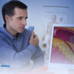 ما هي علاج انسداد الشريان التاجى؟