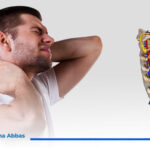 علاج انسداد شرايين الرقبة