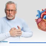 افضل طرق علاج انسداد شرايين القلب بدون جراحة