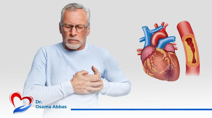 علاج شرايين القلب بدون جراحة علاج انسداد شرايين القلب بدون جراحة