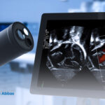 عملية اصلاح العيوب الخلقية بالمنظار