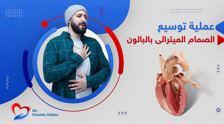 عملية توسيع الصمام الميترالى بالبالون عملية توسيع الصمام الميترالى بالبالون