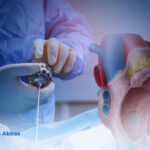 غلق الثقب بين الأذينين بالمنظار بدون شق الصدر