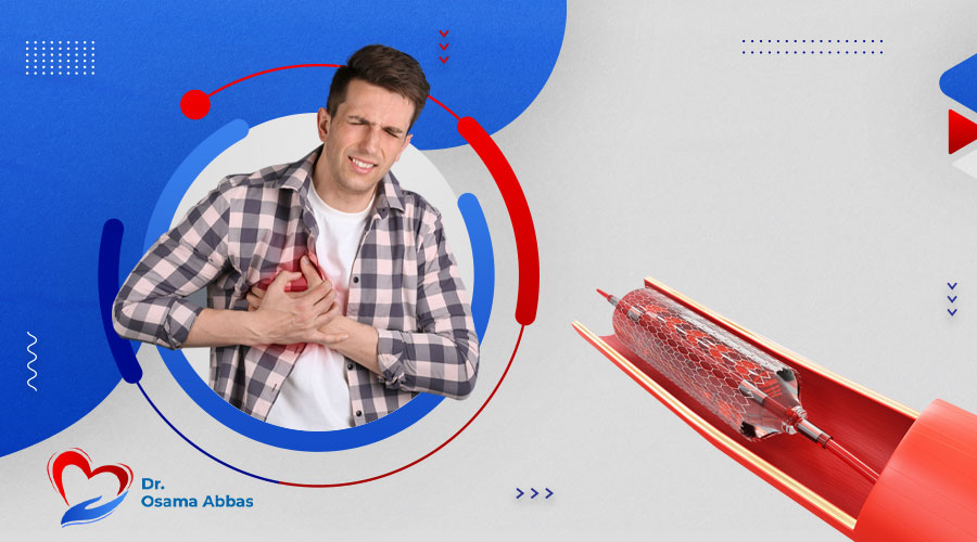 تفاصيل عملية قسطرة الشريان التاجي|تفاصيل-عملية-قسطرة-الشريان-التاجي قسطرة الشريان التاجي|قسطرة الشريان التاجي