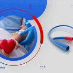 ما هي القسطرة التشخيصية؟ وما الفرق بينها وبين الأشعة المقطعية؟