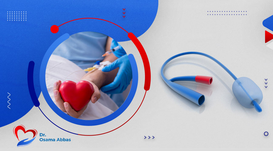 ما هي القسطرة التشخيصية|