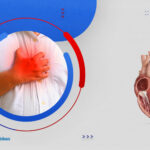 تعرف على أشهر مضاعفات عملية تغيير صمام القلب وكيفية الوقاية منها