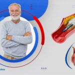 نصائح بعد عملية قسطرة القلب – مع دكتور أسامة عباس