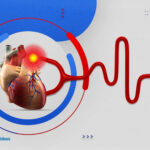 رسم القلب | متى نلجأ اليه؟