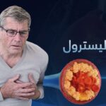 اعرف أكثر عن اعراض ارتفاع الكوليسترول ووسائل تشخيصه وعلاجه