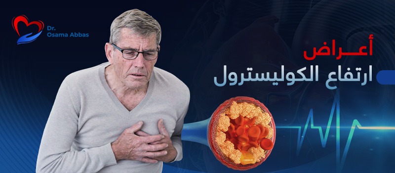 اعراض ارتفاع الكوليسترول اعراض ارتفاع الكوليسترول