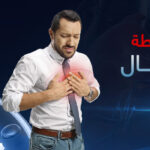 هل تختلف اعراض الجلطة عند الرجال عن النساء؟