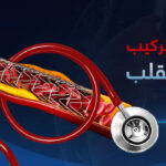 أهم نصائح بعد تركيب دعامات القلب، الأدوية ليست كل شيء