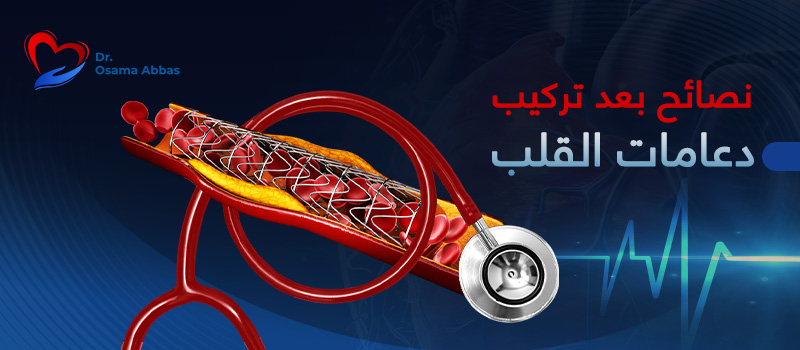 نصائح بعد تركيب دعامات القلب نصائح بعد تركيب دعامات القلب