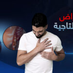 ما هي أعراض أمراض الشرايين التاجية، جرس إنذار لإنقاذ حياتك؟