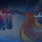 علاج شرايين القلب المسدودة تقنية تنقذ حياة المرضى بلا مضاعفات