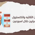 علاج الدهون الثلاثيه والكلسترول وتصلب الشرايين خلال اسبوعين