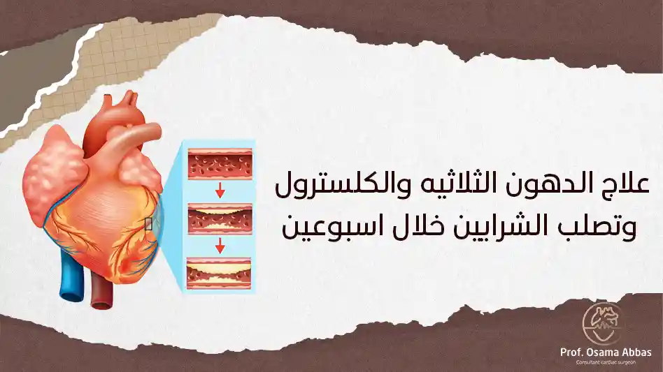 علاج الدهون الثلاثيه والكلسترول وتصلب الشرايين خلال اسبوعين علاج الدهون الثلاثيه والكلسترول وتصلب الشرايين خلال اسبوعين