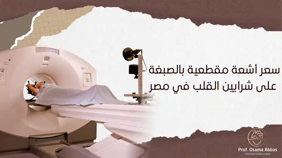 سعر أشعة مقطعية بالصبغة على شرايين القلب في مصر سعر أشعة مقطعية بالصبغة على شرايين القلب في مصر