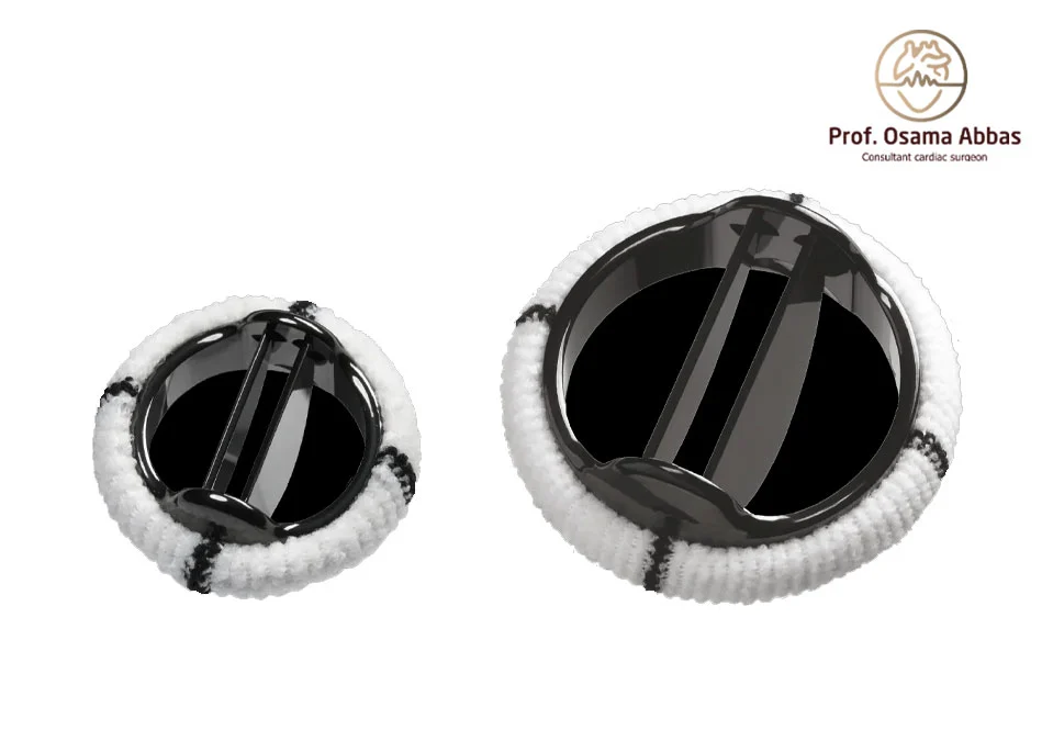 صمام ميكانيكي معدني