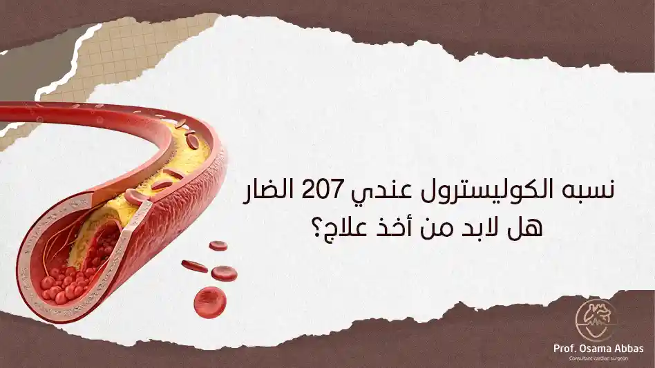 نسبه الكوليسترول عندي 207 الضار هل لابد من أخذ علاج نسبه الكوليسترول عندي 207 الضار هل لابد من أخذ علاج