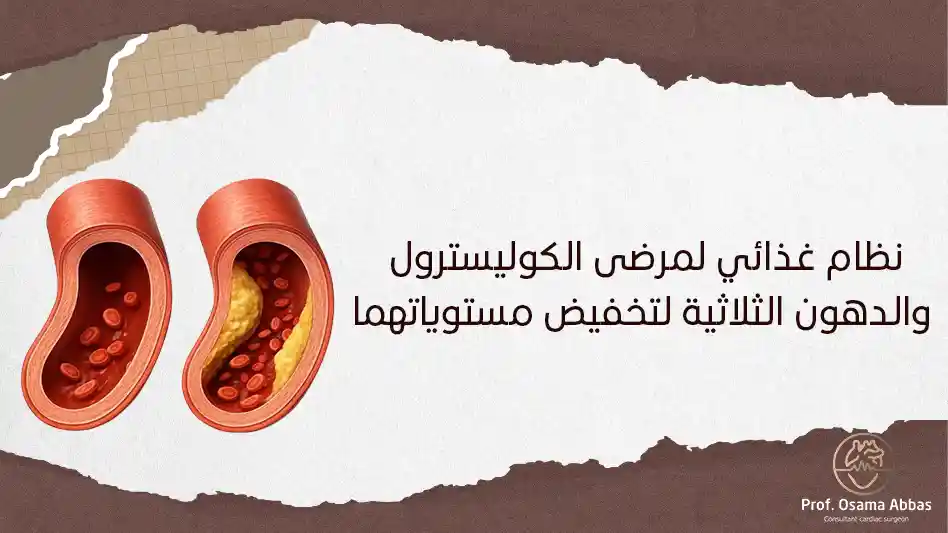 نظام غذائي لمرضى الكوليسترول والدهون الثلاثية لتخفيض مستوياتهما نظام غذائي لمرضى الكوليسترول والدهون الثلاثية لتخفيض مستوياتهما
