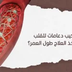 هل تركيب دعامات القلب يتطلب أخذ العلاج طول العمر؟
