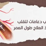 هل تركيب دعامات للقلب يتطلب أخذ العلاج طول العمر؟