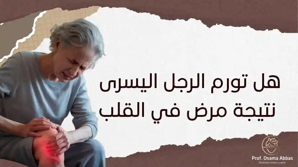 هل تورم الرجل اليسرى هل تورم الرجل اليسرى نتيجة مرض في القلب