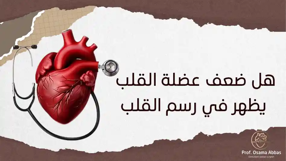هل ضعف عضلة القلب يظهر في رسم القلب هل ضعف عضلة القلب يظهر في رسم القلب
