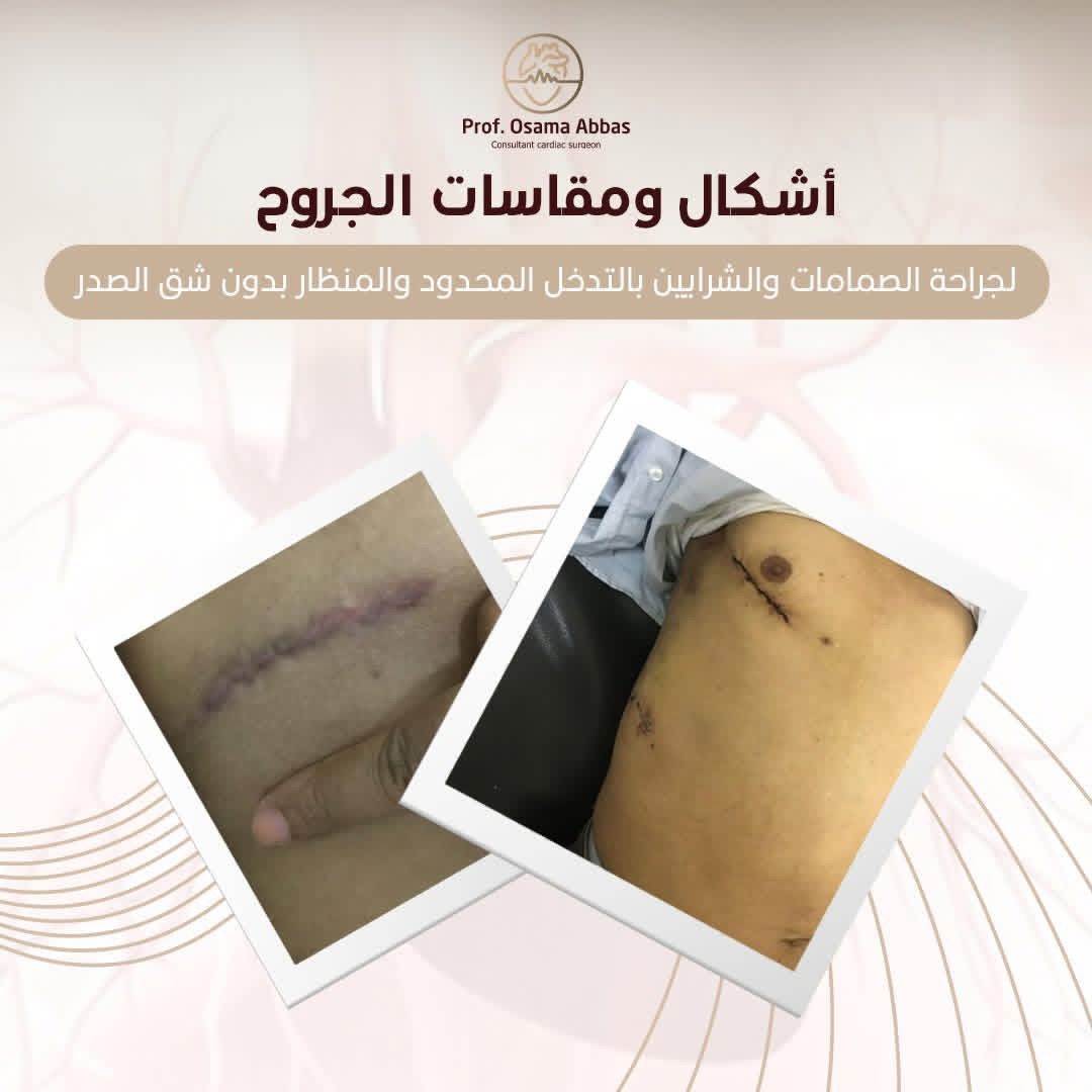 اشكال ومقاسات الجروح